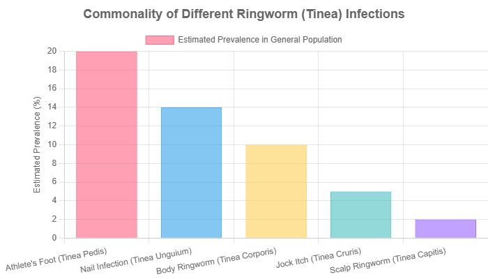 Commonality of different ringworm (tinea) infections