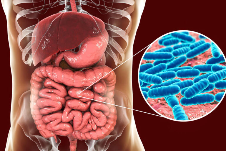 how-to-improve-your-gut-microbiome-an-actionable-guide