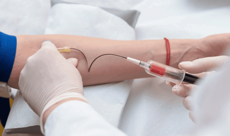 Cholesterol: A Complete Guide to Understanding Your Levels