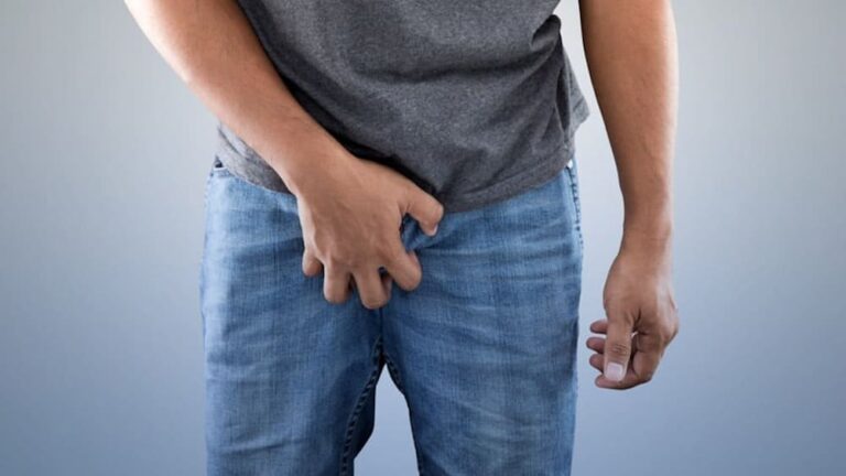 How to get rid of jock itch fast