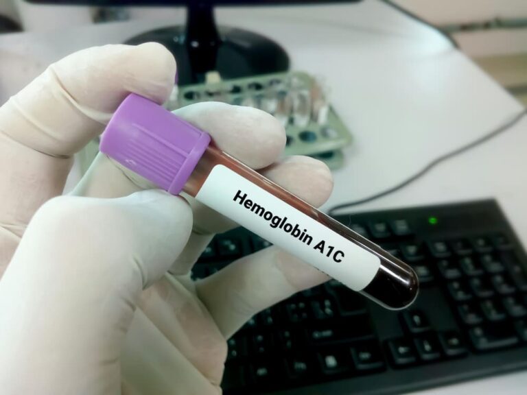 11 Proven ways to lower your A1c levels naturally