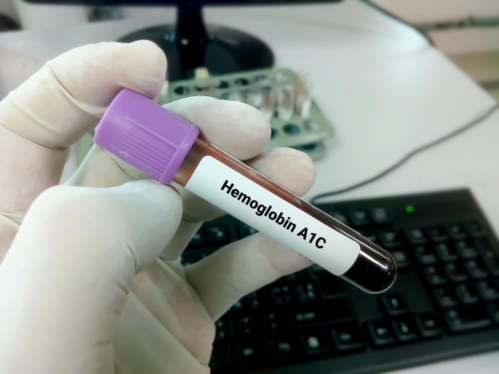 11 Proven ways to lower your A1c levels naturally