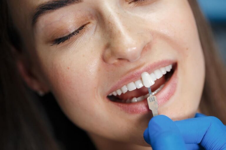 Dental Veneers: The Pros and Cons