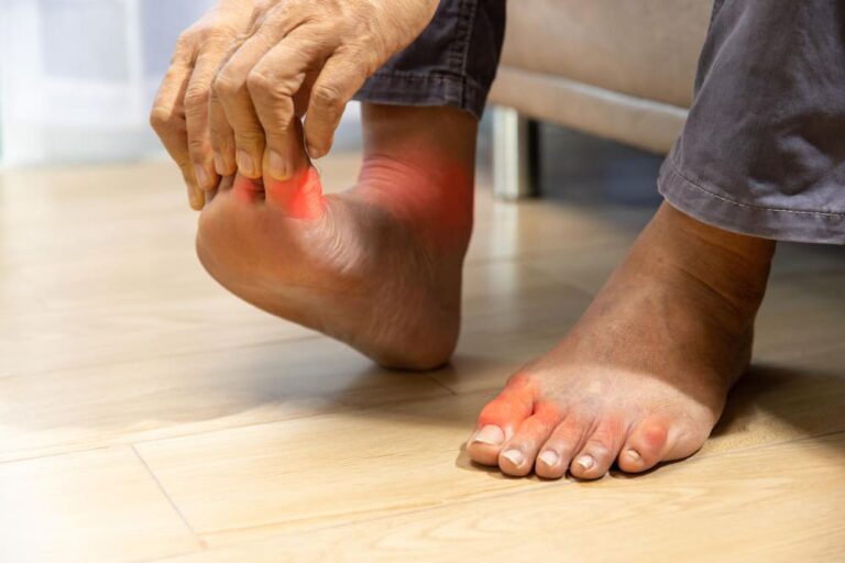 Peripheral Neuropathy: The Different Types