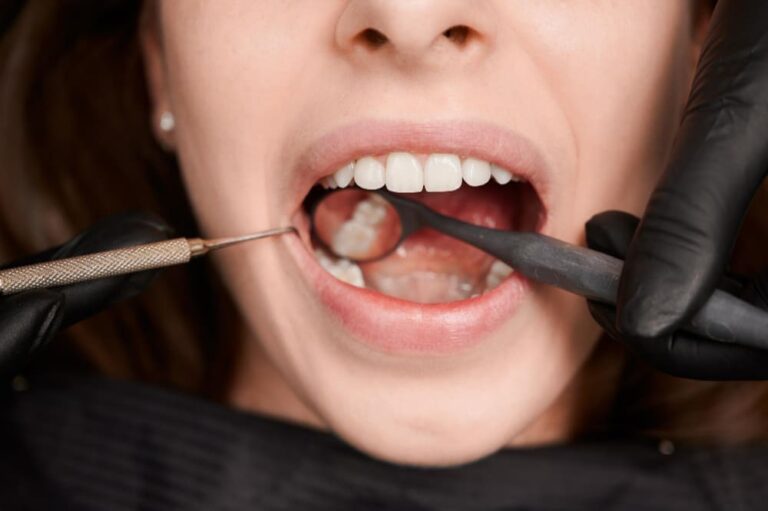 The 5 Telltale Signs You Might Have a Cavity