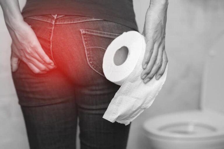 Hemorrhoids Symptoms and Treatments: A Complete Guide